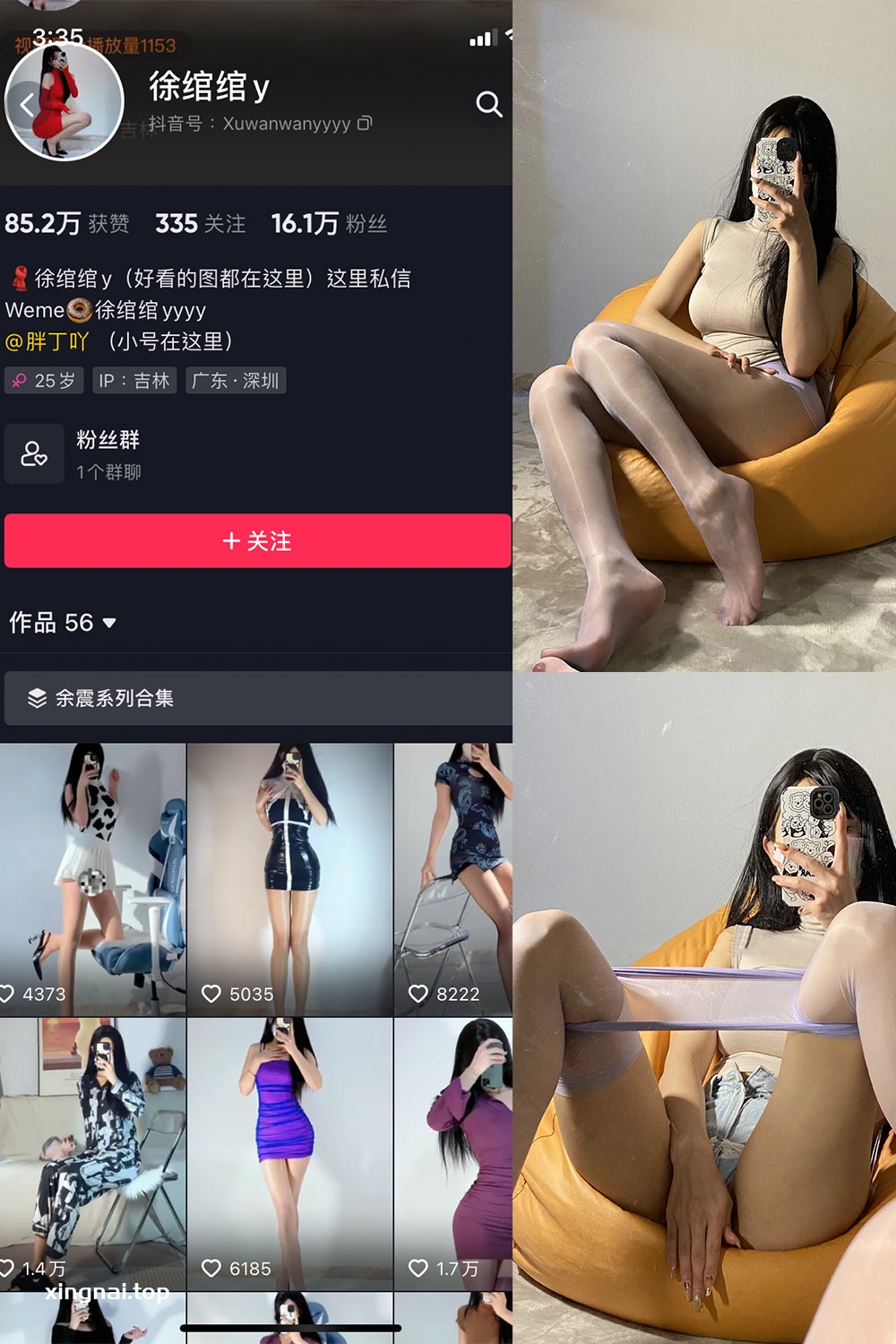 抖音 徐绾绾 微密圈  NO.001期 【37P】