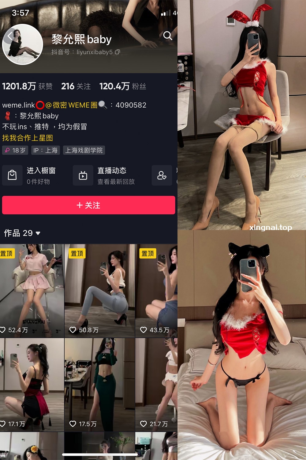 抖音 黎允熙baby 微密圈  NO.007期 【13P】