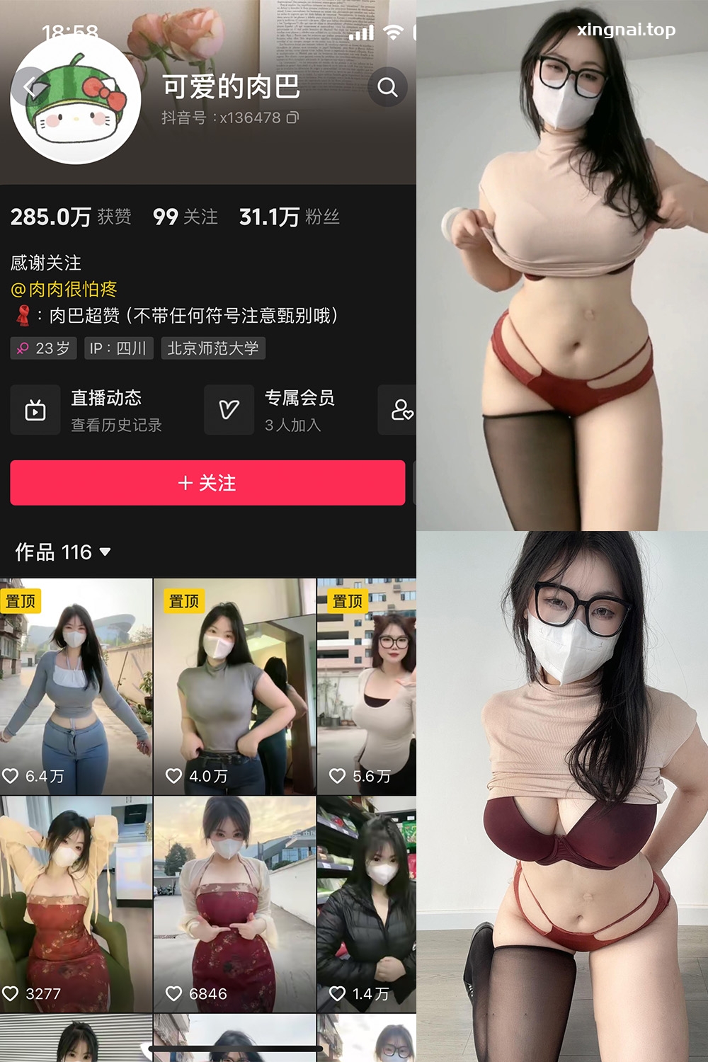 抖音 可爱的肉巴 微密圈  NO.009期 【18P11V】最新至：2024.11.7