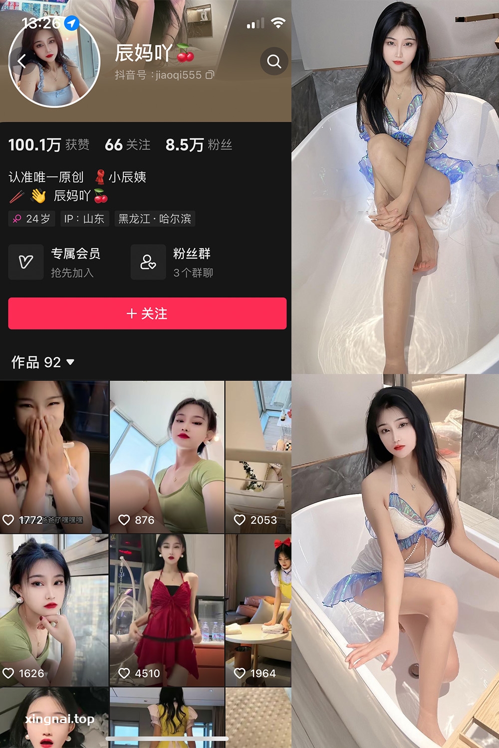 抖音 辰妈吖 微密圈  NO.001期 【32P4V】