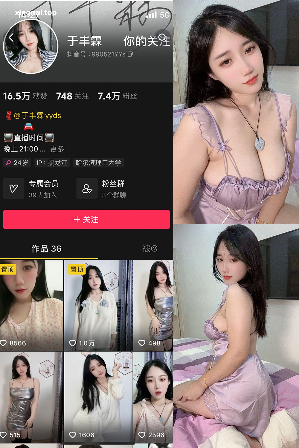 抖音 于丰霖 微密圈 NO.009期 【19P12V】最新至：2024.9.8