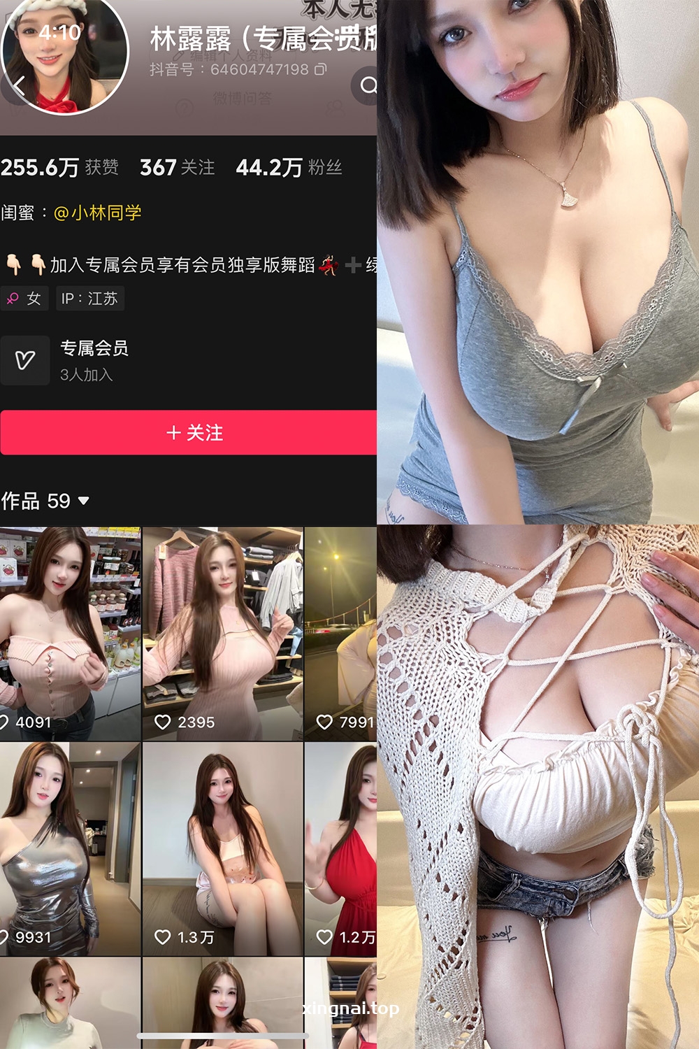 抖音 林露露 微密圈  NO.006期 【82P】