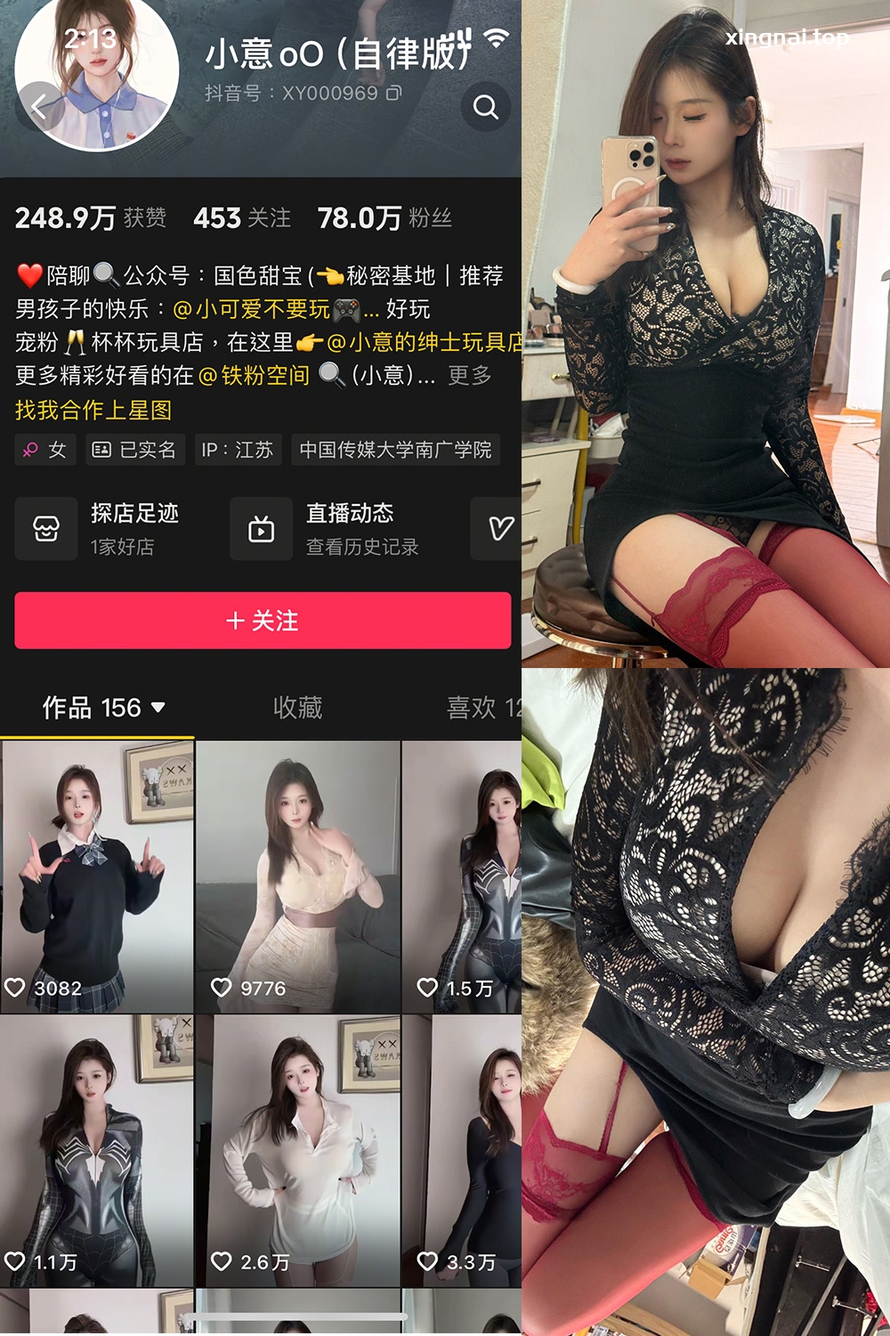 抖音 小意 微密圈  NO.003期 【15P1V】最新至：2025.3.10